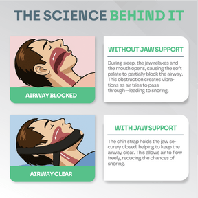 Anti Snoring Sleep Chin Strap Snooze Therapy